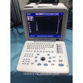 Tragbare Ultraschall-Scan-Maschine MT300V